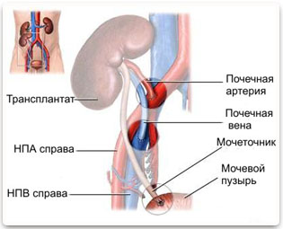 Пересадка органов и тканей